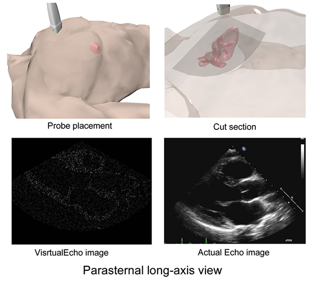 Parasternal long axis view