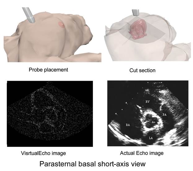 Parasternal basal short axis view