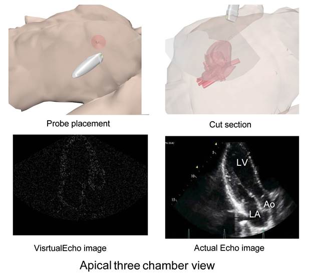 Apical three chamber view