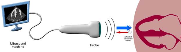 Ultrasound principles: How an ultrasound image is generated